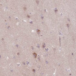 GEFT Antibody, Novus Biologicals 0.1mL; Unlabeled:Antibodies, Polyclonal